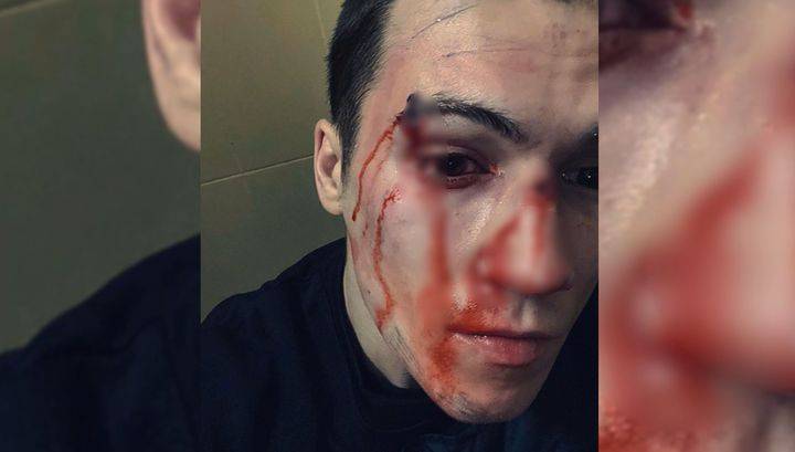 Бойца ММА избили в Москве на глазах его девушки
