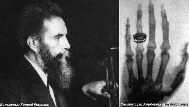 Этот день в истории: 1895 год — Рентген поведал миру об открытых им лучах