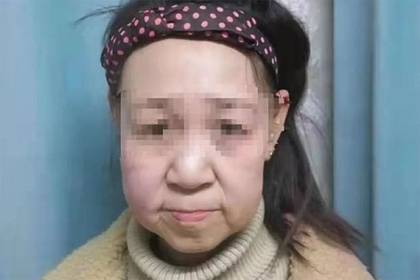 Девочку с лицом старушки прозвали уродливой и вынудили бросить школу - lenta.ru - Китай - провинция Ляонин