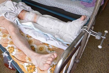 В российской больнице инвалида заставили снимать гипс плоскогубцами