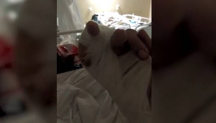 Жительница Волгограда, защищавшая своего пса, потеряла палец в драке с собакой