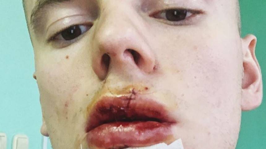 «Мой новый день рождения»: Сын Валерии показал разорванную после ДТП губу