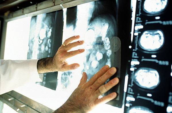 В прикамской больнице приставы опечатали рентгеновские аппараты