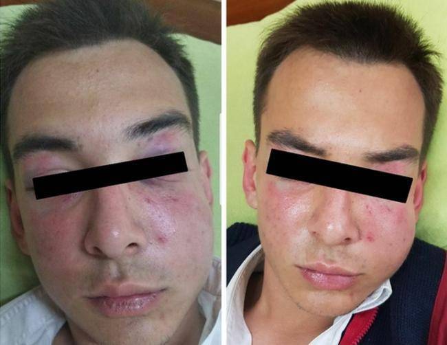 Драка ташкентских школьников под прицелом милиции | Вести.UZ