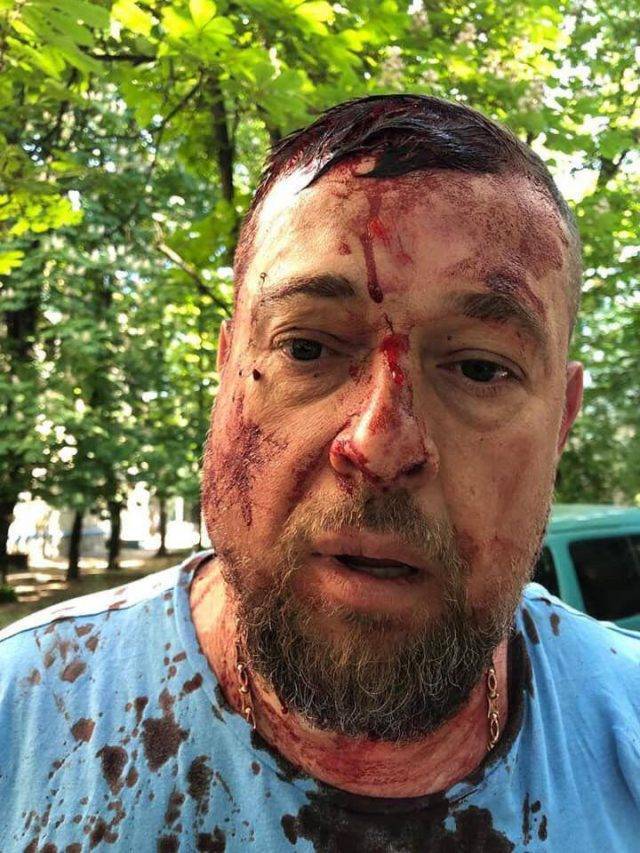 Харьковского «патриота» из «Нацкорпуса» жестоко избили неизвестные