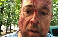 В Харькове избили активиста Нацкорпуса. 18+