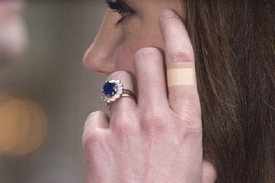 Кейт Миддлтон привлекла внимание «вечным» пластырем на пальцах - versia.ru - Англия