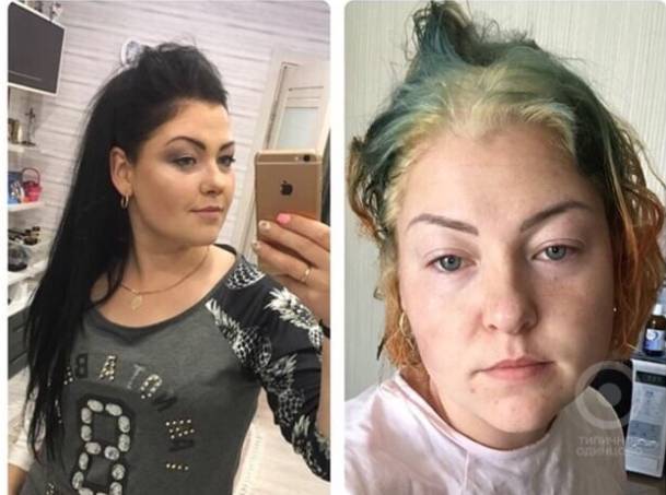 Женщина обвинила стилиста в ожоге головы после покраски волос