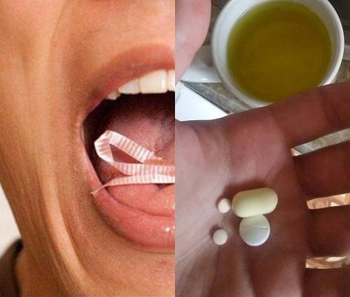 Распространённый симптом дефицита витамина В9: Назван неожиданный признак во рту