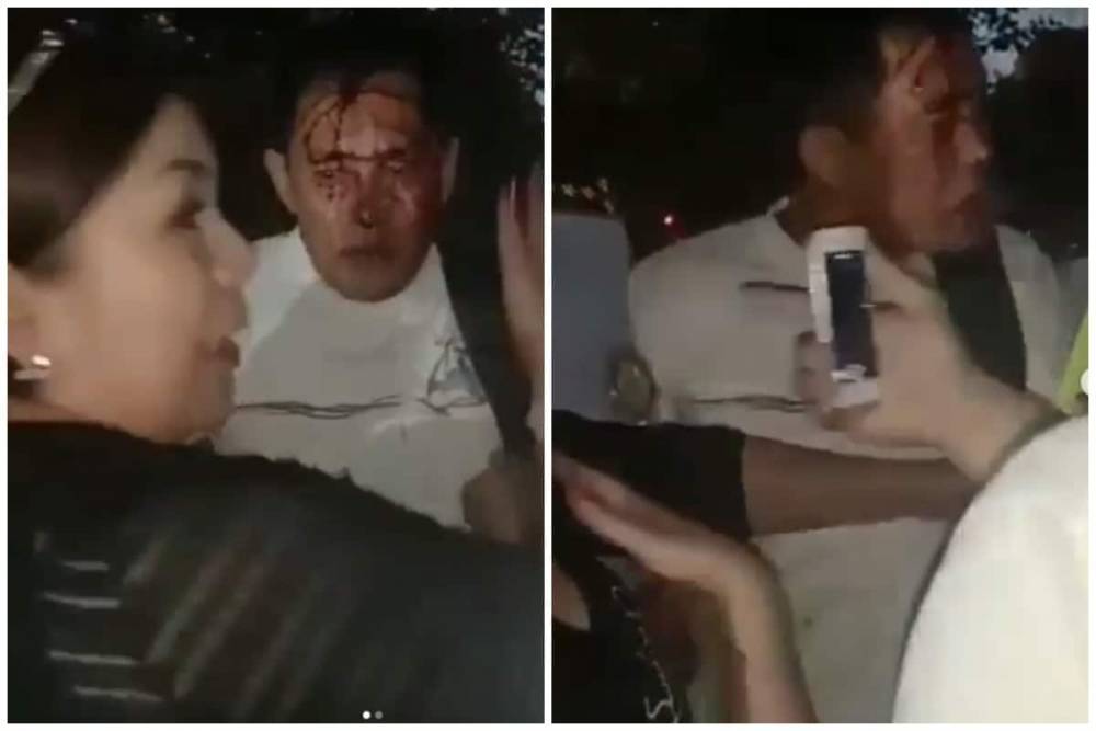 Видео с толпой народа и окровавленным мужчиной прокомментировали в полиции Атырау (видео)