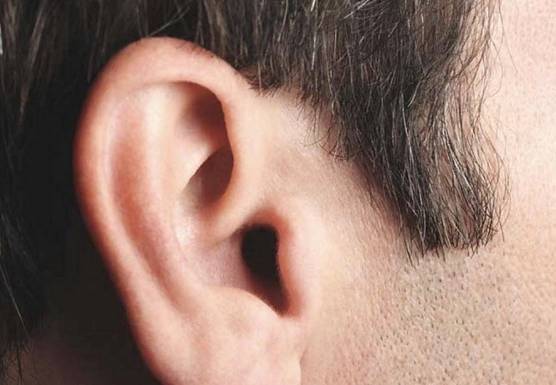 В Англии у мужчины извлечена самая большая в мире ушная пробка