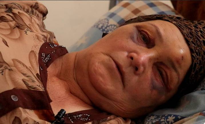 В Сурхандарье пьяные ученики жестоко избили пожилую учительницу | Вести.UZ