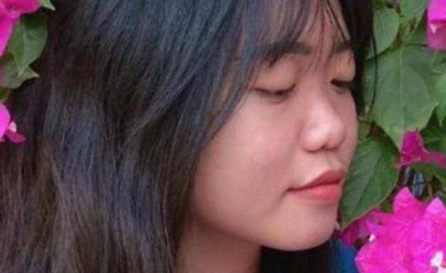 Девушка устала терпеть, что друзья критикуют ее внешность, и сделала пластику носа