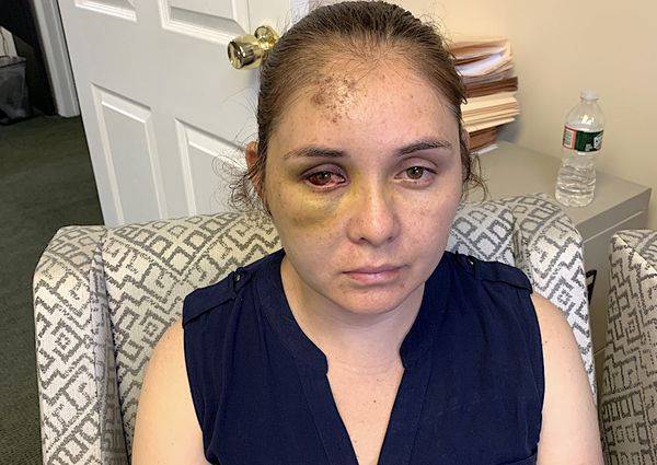 «Возвращайся в Мексику»: американка потеряла сознание после того, как ее избил школьный хулиган, который угрожал ее сыну