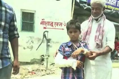 Врачи наложили мальчику гипс на здоровую руку - lenta.ru - India - штат Бихар