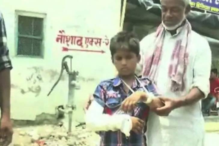 В Индии врачи наложили ребёнку гипс на здоровую руку