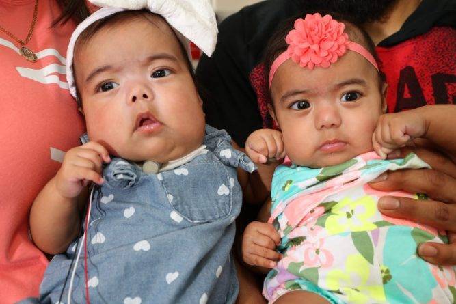 Врачи спасли близнецов, проведя уникальную, но рискованную операцию по удалению огромной опухоли во время родов