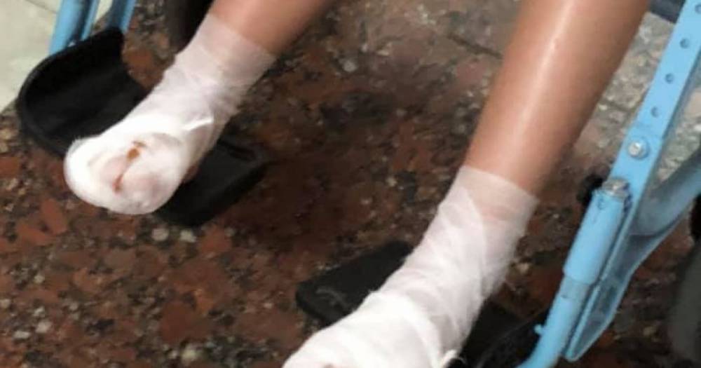 Под Киевом девочка получила ожоги ног, катаясь на аттракционе