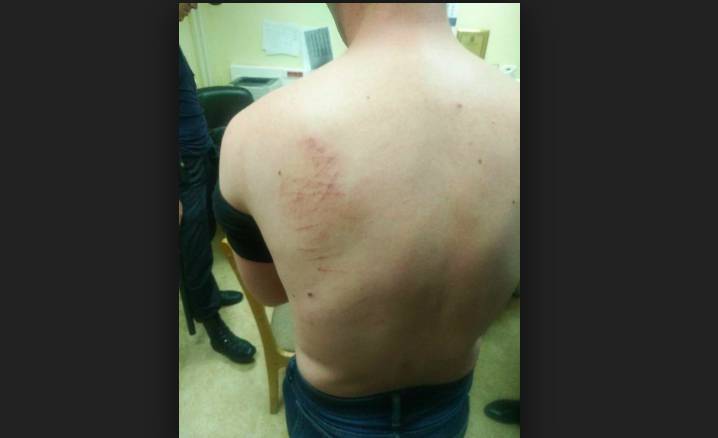 Голунов показал ушибы и царапины на спине. Опубликована первая видеозапись с момента его задержания