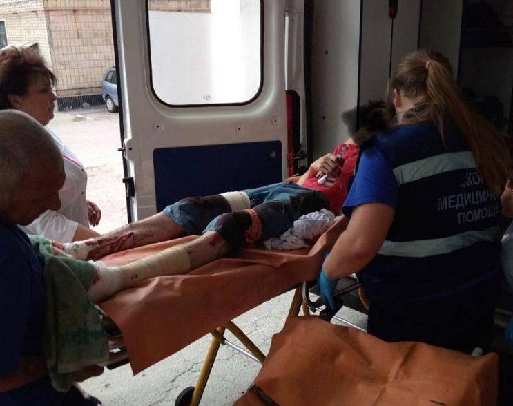 В ДНР сработало неопознанное взрывное устройство, тяжело ранен подросток