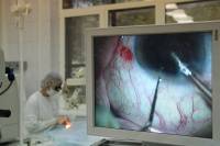 Рязанские врачи спасли мужчине глаз, в который попал кусок дерева | РИА «7 новостей»