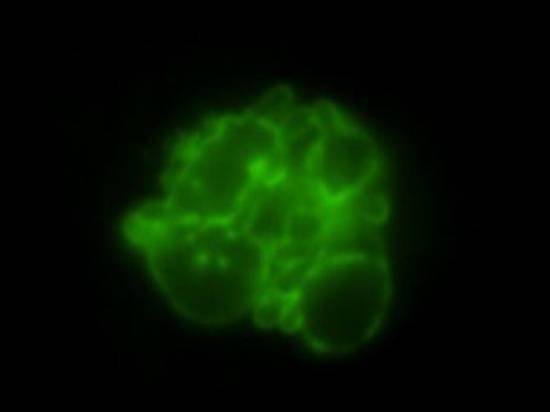 Ученые МГУ нашли способ приблизить «старость» раковых клеток