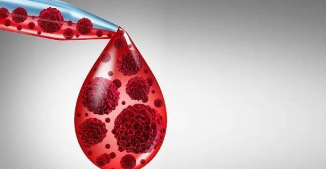 Рак крови: 6 ранних признаков, которые нельзя игнорировать