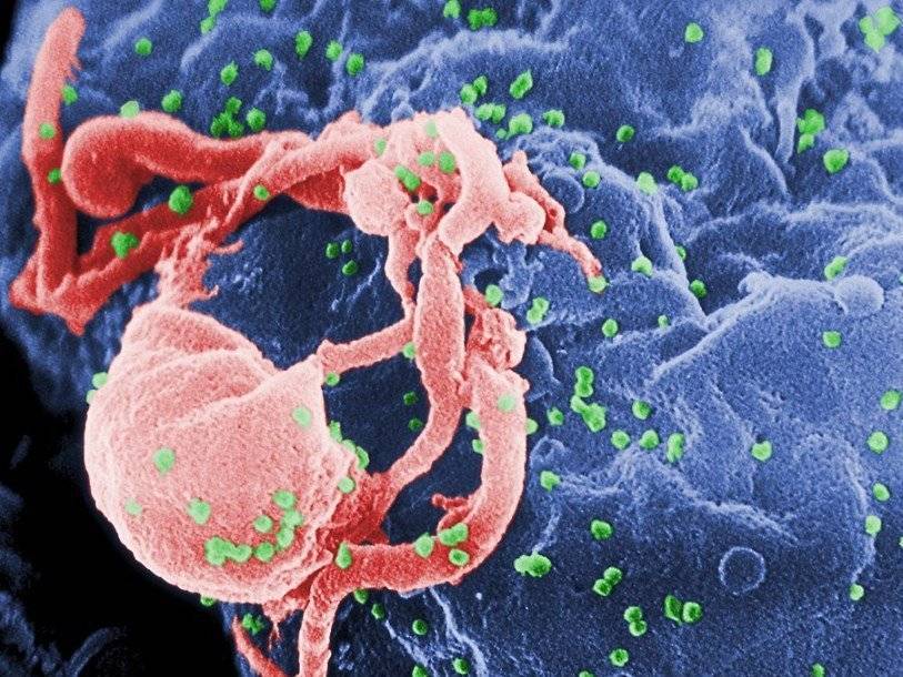Геном вируса иммунодефицита человека выделен из образцов ткани полувековой давности