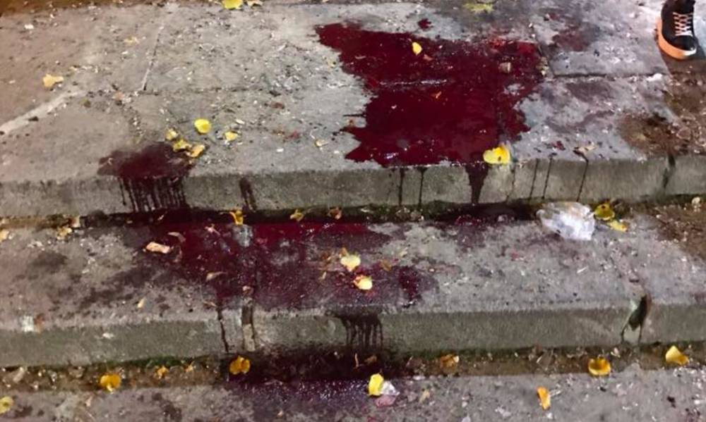 Пьяный неадекват напал с ножом на компанию молодых людей в Смоленске