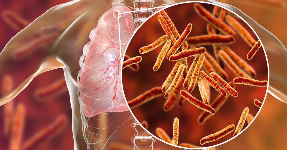 Учёные нашли возбудителей туберкулёза в&nbsp;клетках