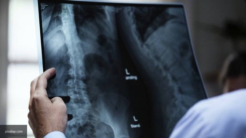 Специалисты нашли зависимость между рентгеном и возникновением рака