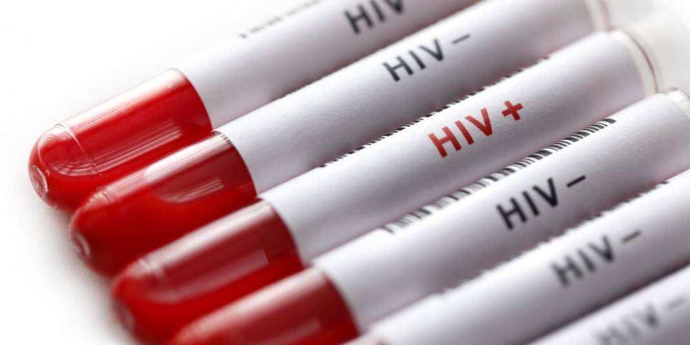 В 13 российских регионах ВИЧ заражены не менее 1% населения