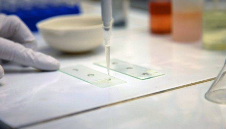 Ученые удалили все следы ВИЧ из тела «очеловеченных» мышей