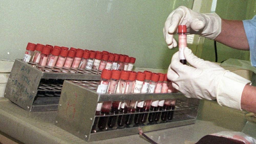 Нигде ВИЧ не распространялся так быстро, как в России, но сегодня у врачей есть "ключ" для спасения - эксперт
