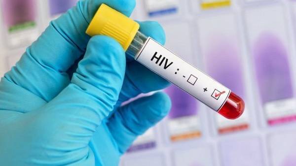 Вирус СПИДа уничтожен в генном тестировании, что послужит решающим шагом к излечению