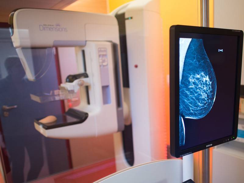 Десятки тысяч женщин сделали маммографию в Москве
