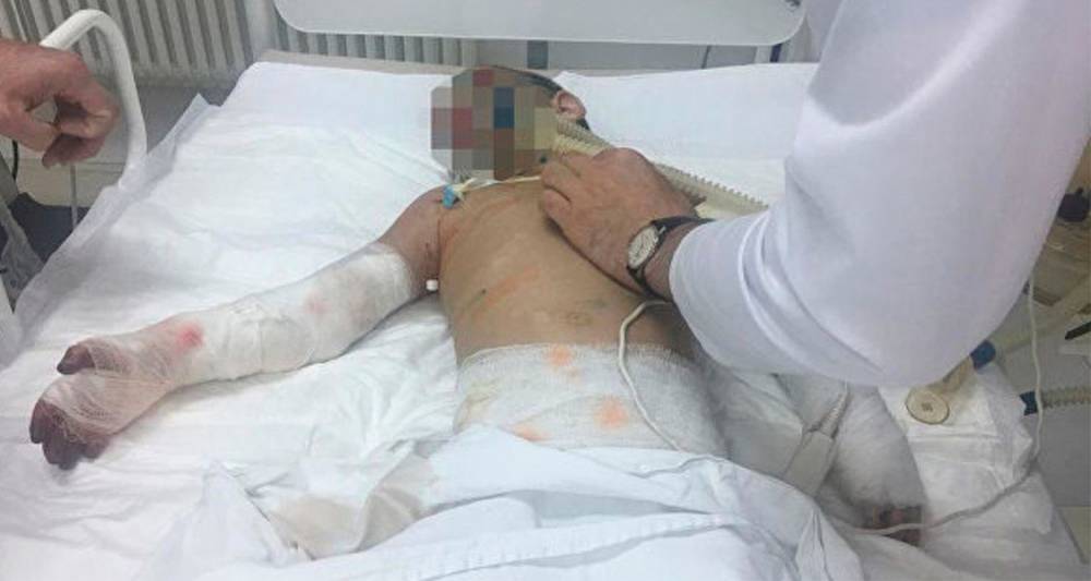 В НИИ детской хирургии рассказали о состоянии избитой девочки в Ингушетии