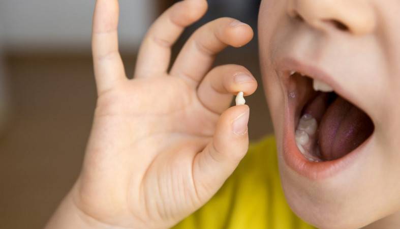 Стоматологи перестали отдавать детям вырванные молочные зубы — Информационное Агентство "365 дней"