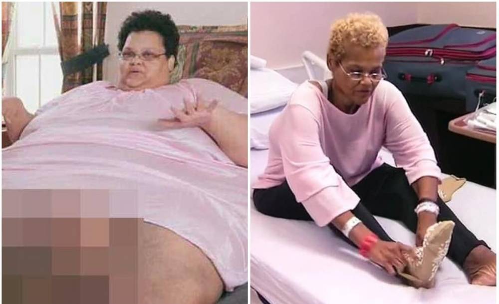 340-килограммовая женщина похудела на 270 килограммов