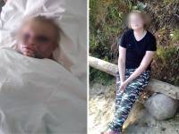 В Кимрах две женщины из-за ревности избили девушку до полусмерти, пострадавшая в реанимации  - ТИА