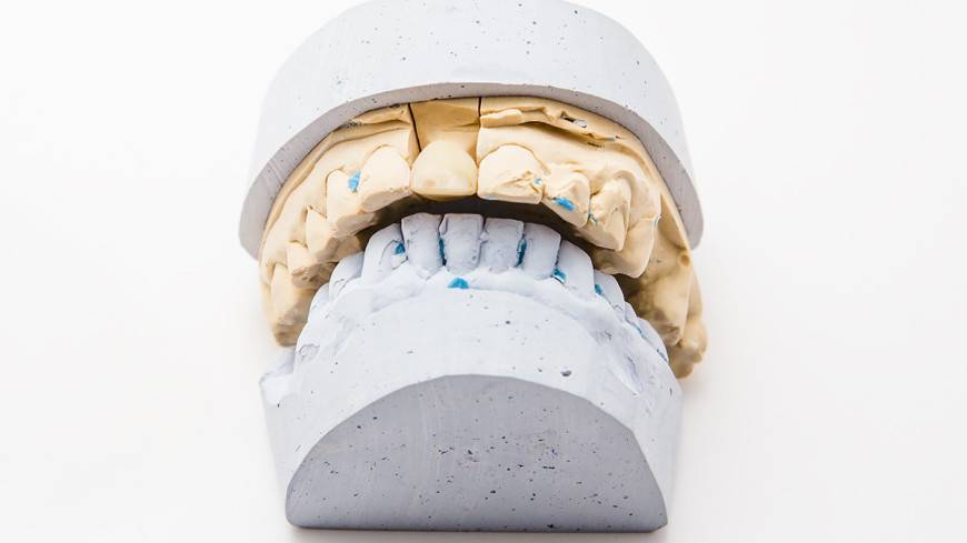 Найдена молекула, восстанавливающая разрушенные зубы