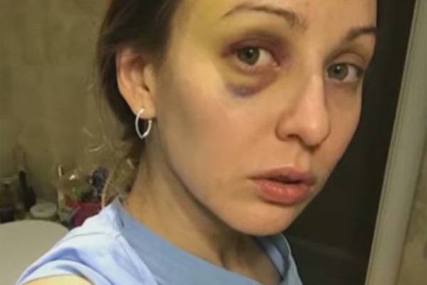 Жительница Челябинска получила три года условно за самооборону