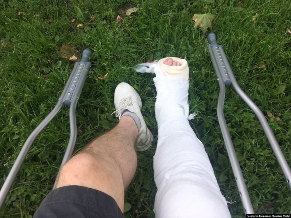 СК одобрил действия полицейских, сломавших ногу дизайнеру