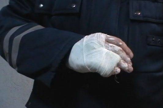 Пьяный водитель сломал палец сотруднику ГИБДД