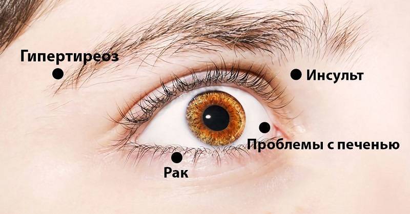 8 сигналов, при помощи которых глаза предупреждают о проблемах со здоровьем! Обрати внимание! — Информационное Агентство "365 дней"