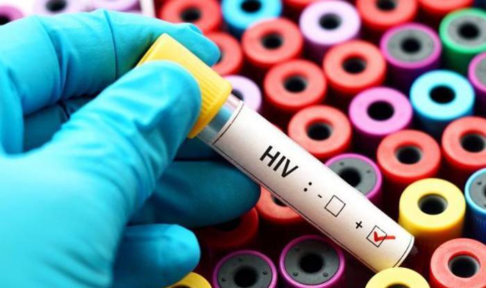 Минздрав сэкономил на главном лекарстве от ВИЧ. Эксперт рассказал, что теперь понадобятся более дорогие препараты