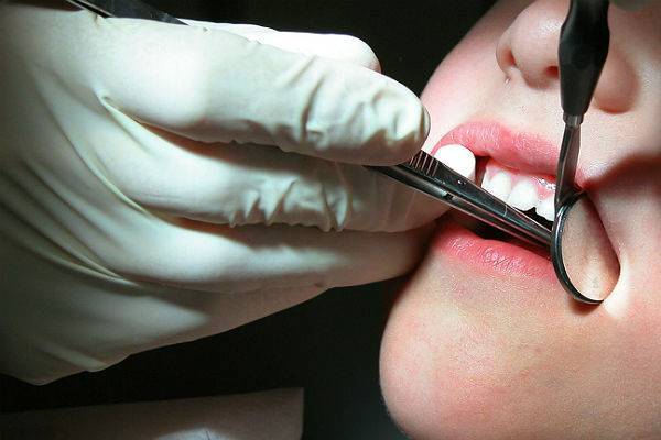 Индийские стоматологи вырвали ребенку 526 зубов