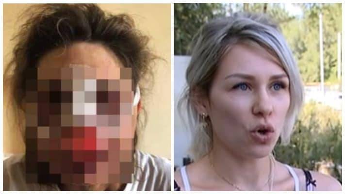 "Была конкретная задача – изувечить лицо": дочь избитой алматинки о нападении
