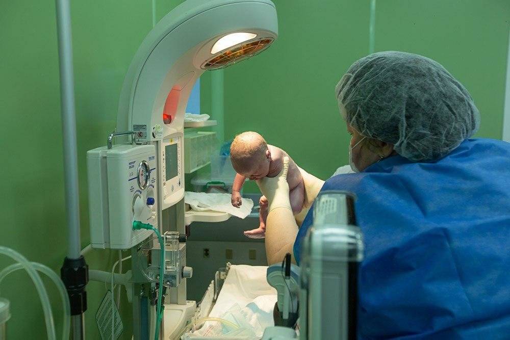 В Чехии ребенок родился спустя два месяца после смерти мозга матери