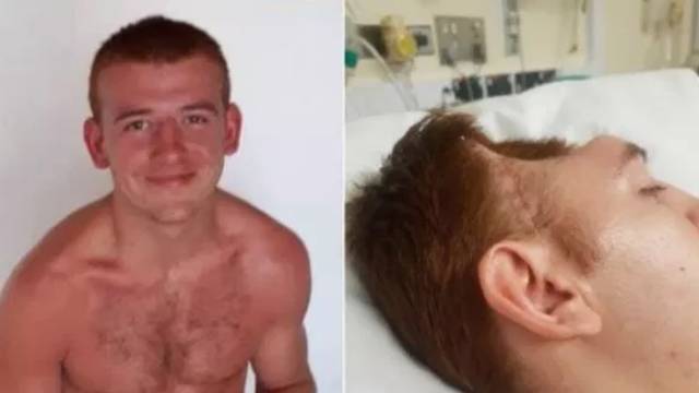 Британец лишился части черепа после кошмарной поездки в магазин (18+). РЕН ТВ - ren.tv - Манчестер